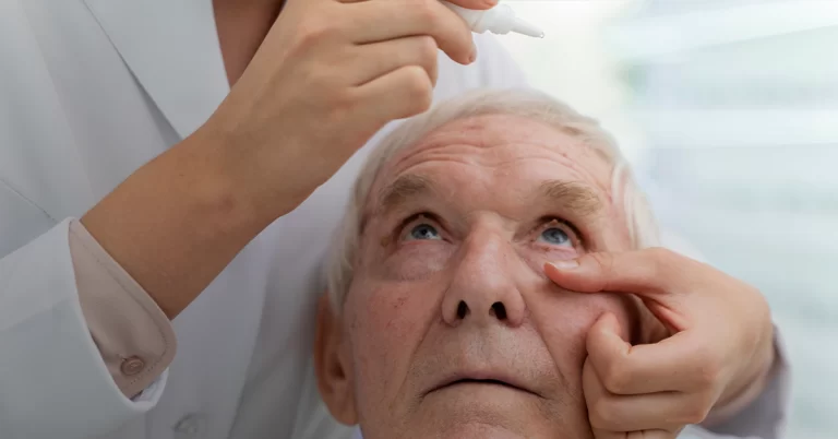 Glaucoma (ग्लूकोमा): Symptoms, Causes & Treatment Guide
